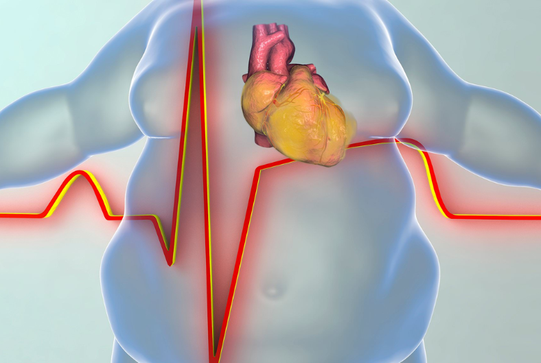 The Impact of Obesity on Heart Health