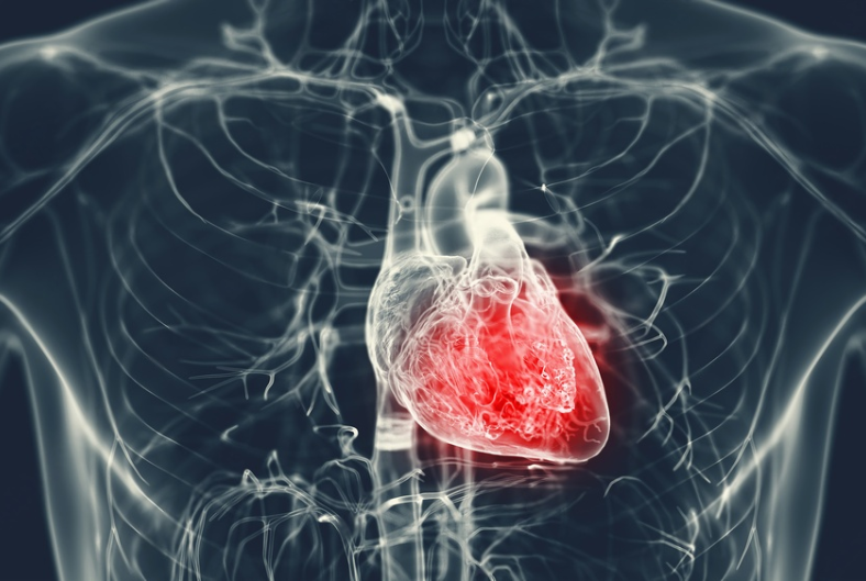 Can Hypertensive Heart Disease Cause Sudden Death?