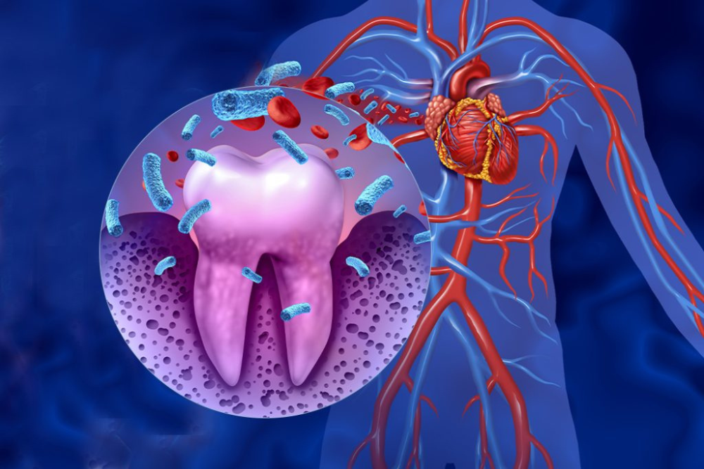 The Link Between Gum Disease and Heart Conditions